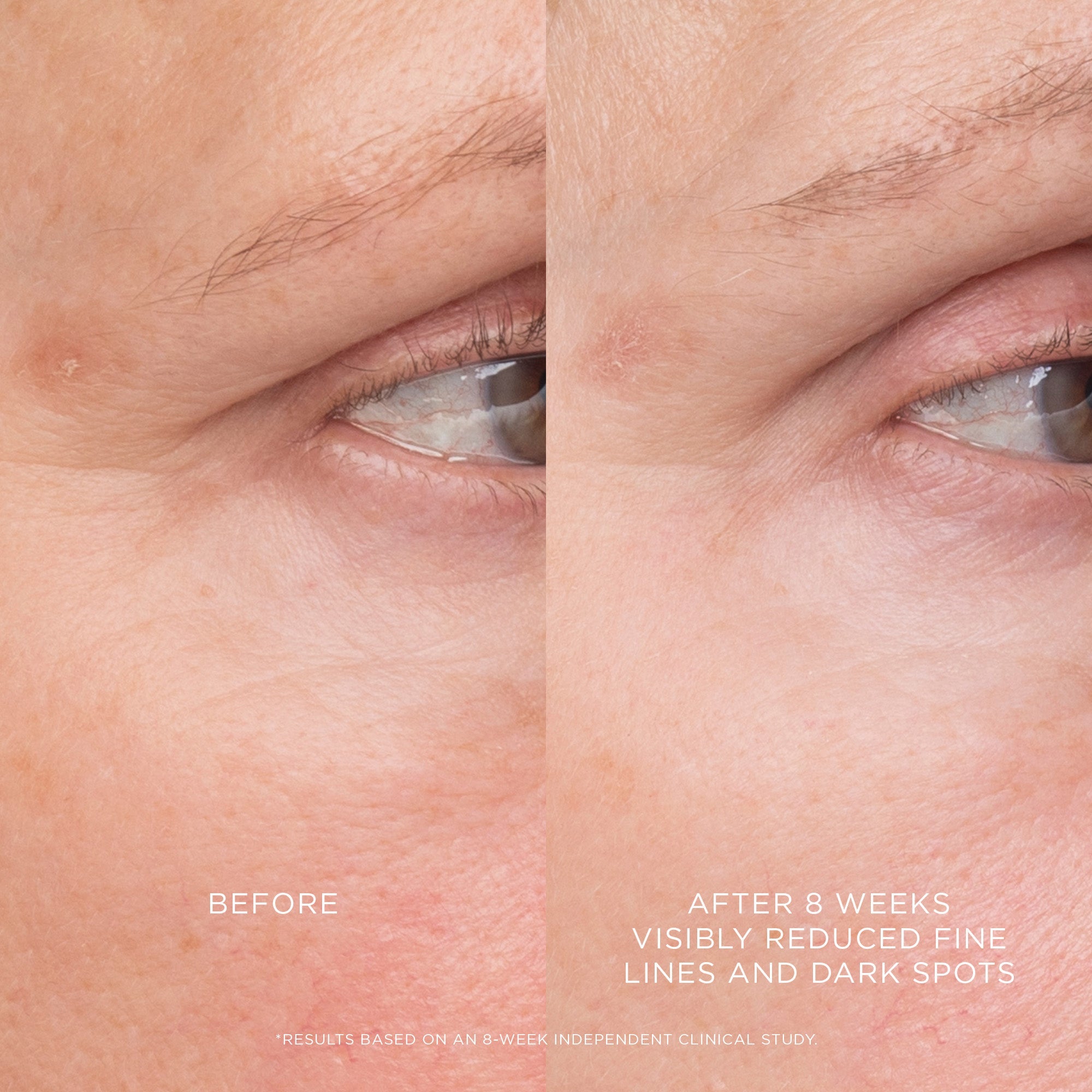 Equilibrium Resurfacing Retinoid Treatment - Image 3