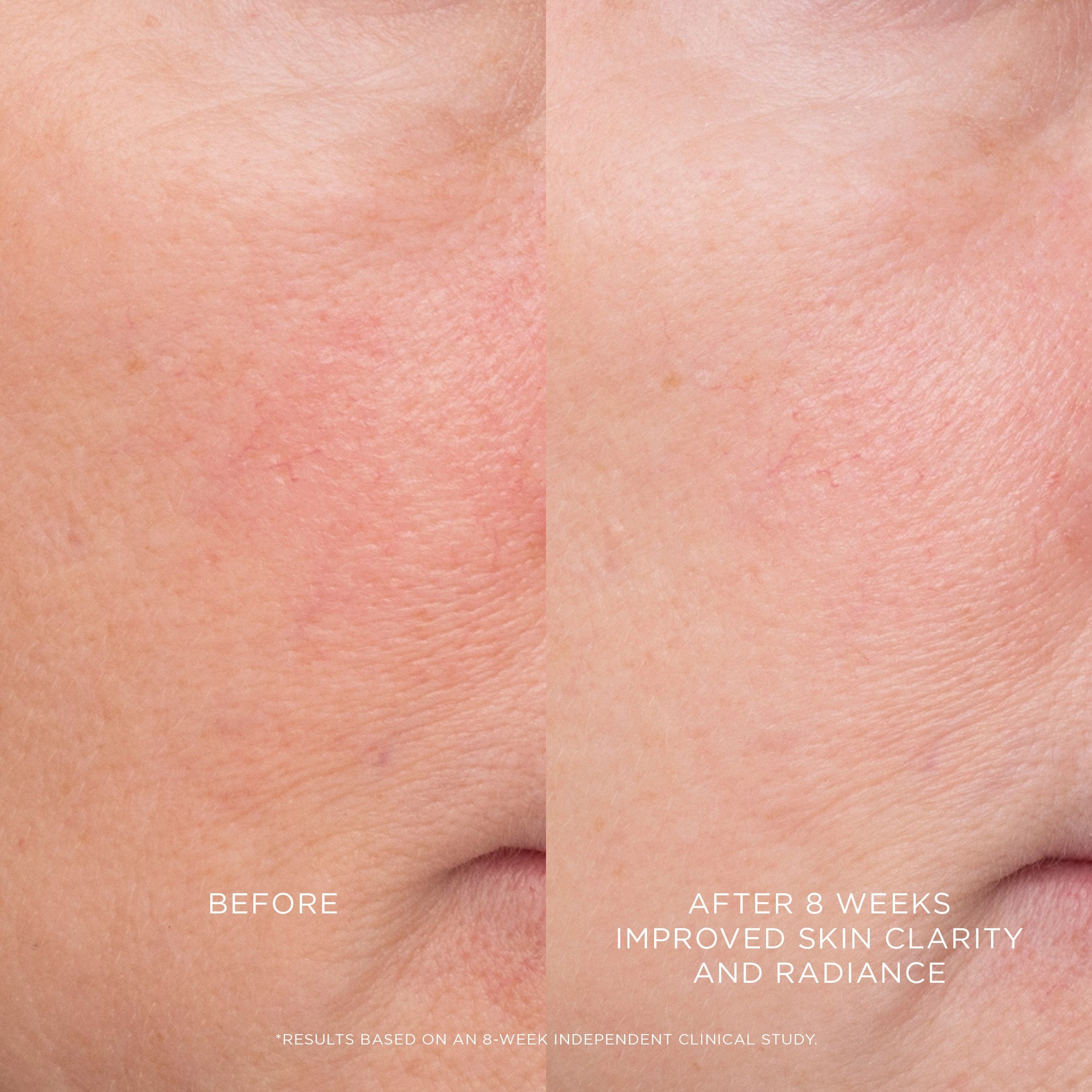 Equilibrium Resurfacing Retinoid Treatment - Image 4